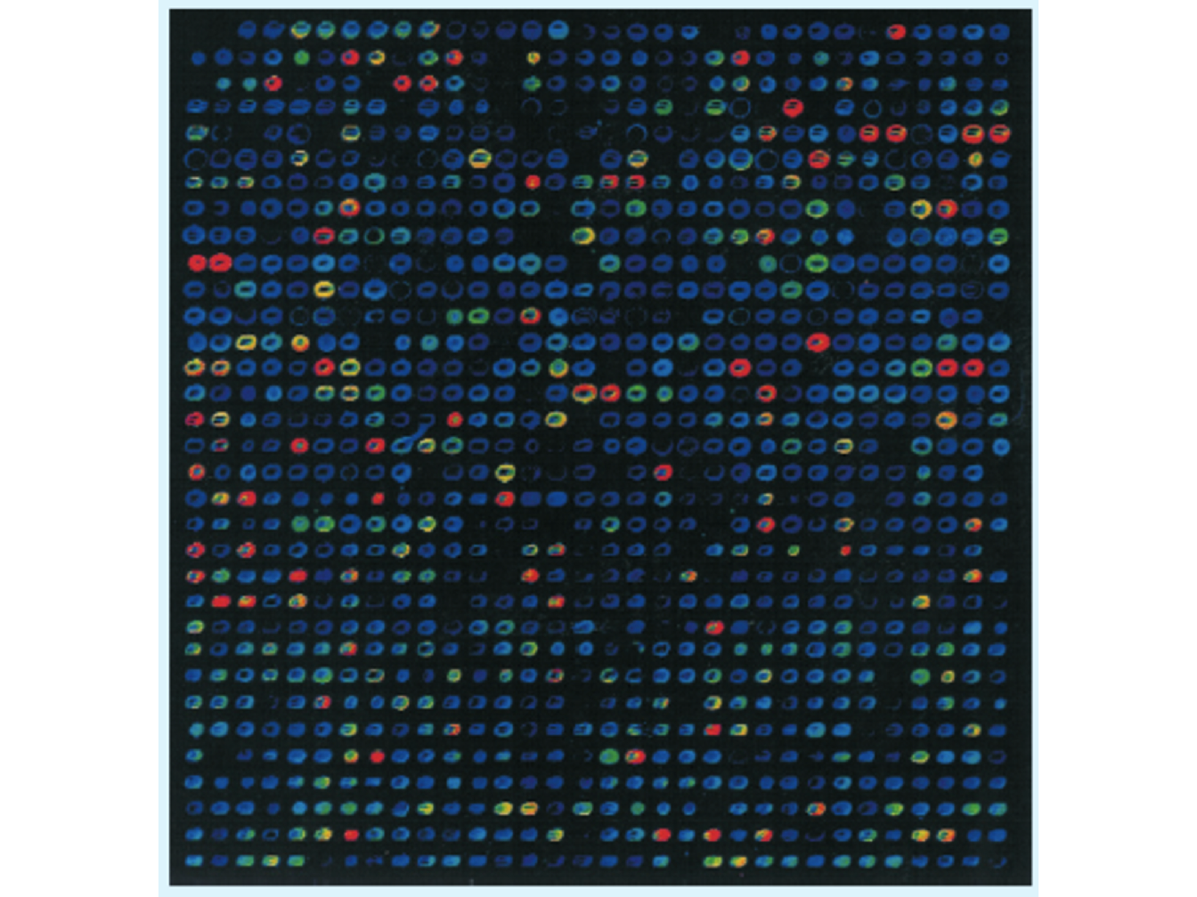 Visualization of the hybridization of a fluorescent labelled probe to a microarray. The DNA to be tested is labelled with a fluorescent marker and put onto the surface of the microarray. Hybridization is detected by examining with a fluorescence microscope the position at which the fluorescent signal is emitted indicating which oligonucleotides have hybridized with the target DNA (Brown et al. 2007).